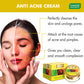 Anti-Acne Cream - Clove & Neem extract (30 gms)