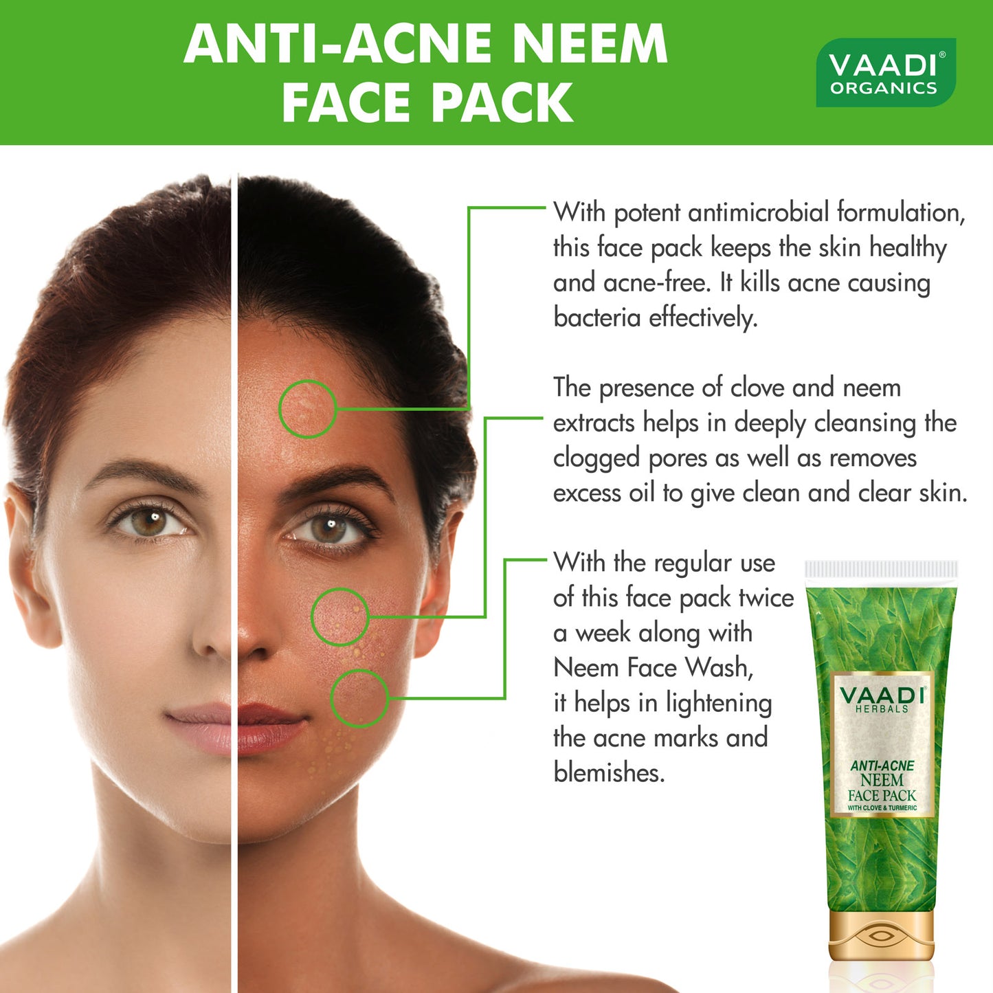 Pack of 2 Anti-Acne Neem Face Pack with Clove & Turmeric (120 gms x 2)