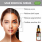 Scar Removal Serum (Pure Mix of Sandalwood Oil, Steam Distilled Neem & Fenugreek Extract) - Reduces Acne, Dark Spots & Pigmentation (2 x 10 ml)