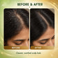 3% SALICYLIC ACID + 1% PIROCTONE OLAMINE ANTI DANDRUFF HAIR SERUM (30 ml)