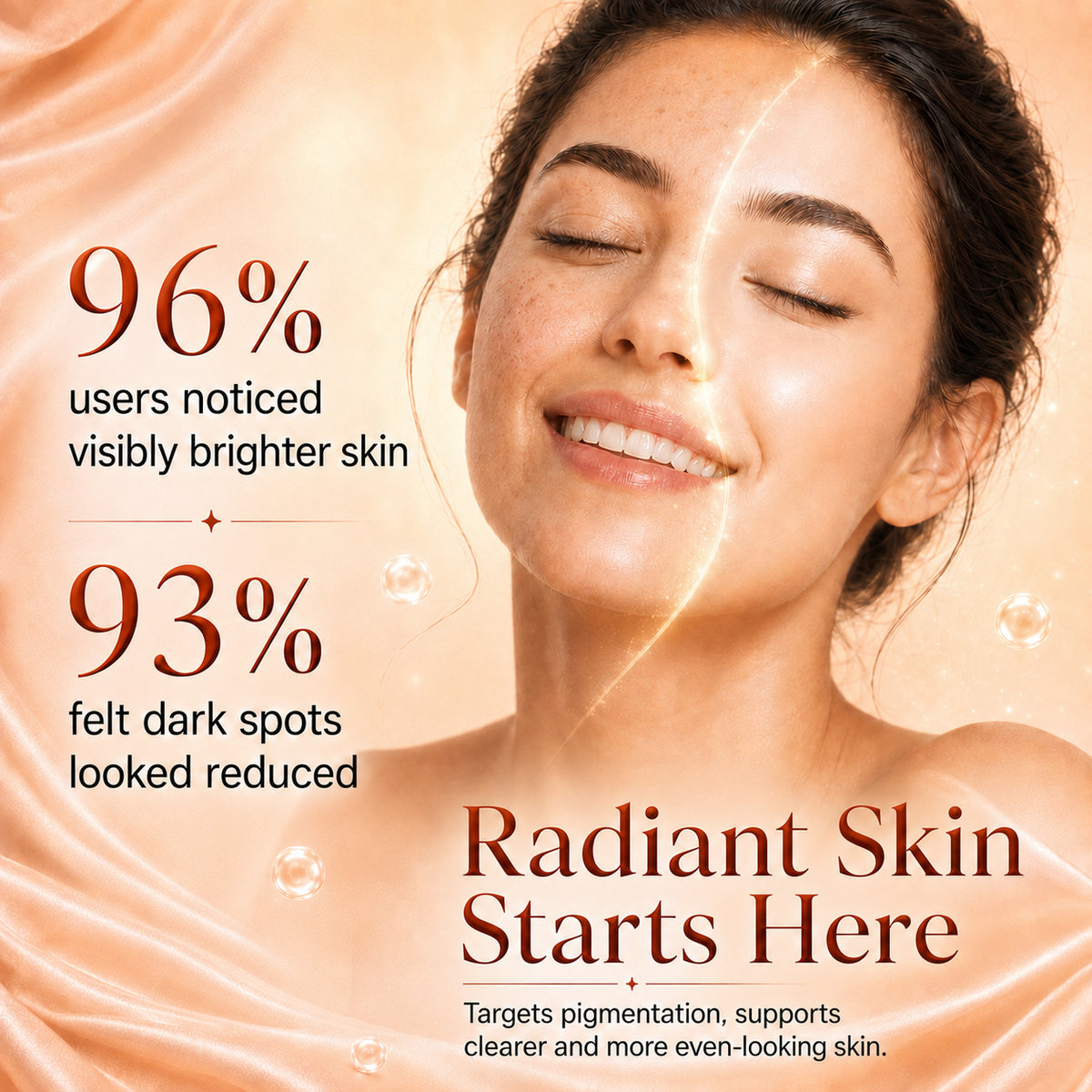 3%Tranexamic and 10% Azelaic Acid Anti Pigmentation Serum with 5% Niacinamide| Brighter Complexion| Reduces Dark Spots| Soothes Inflammation|Fades Hyper pigmentation| For All Skin Types| 30ml