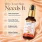 3%Tranexamic and 10% Azelaic Acid Anti Pigmentation Serum with 5% Niacinamide| Brighter Complexion| Reduces Dark Spots| Soothes Inflammation|Fades Hyper pigmentation| For All Skin Types| 30ml